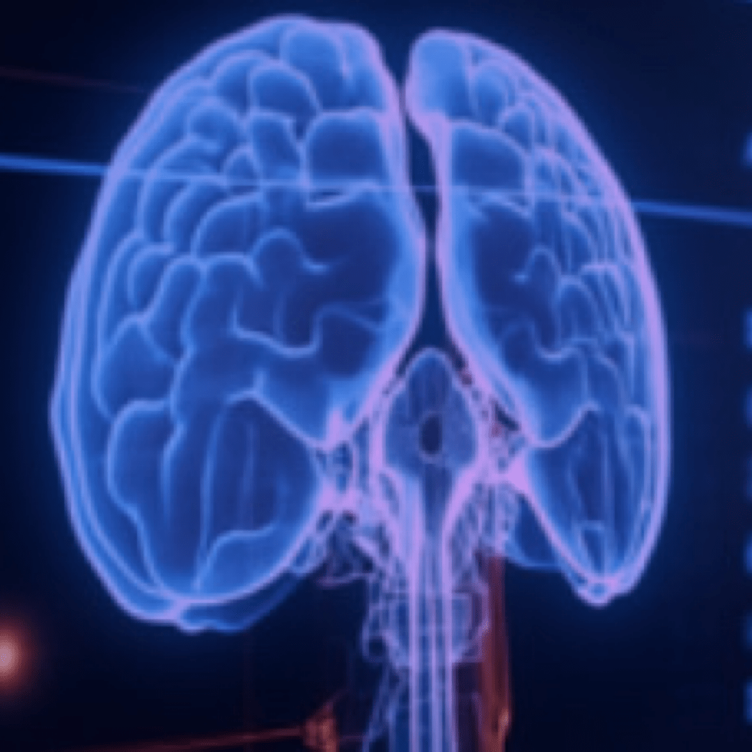 Groundbreaking Ai Tool Accelerates Parkinson’s Disease Diagnosis