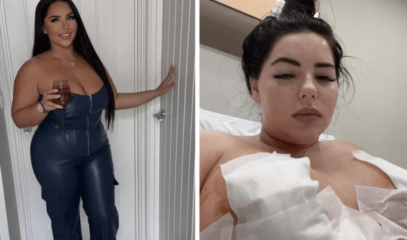 Woman Left in Agony with Dying Nipples After Botched Cosmetic Surgery Abroad