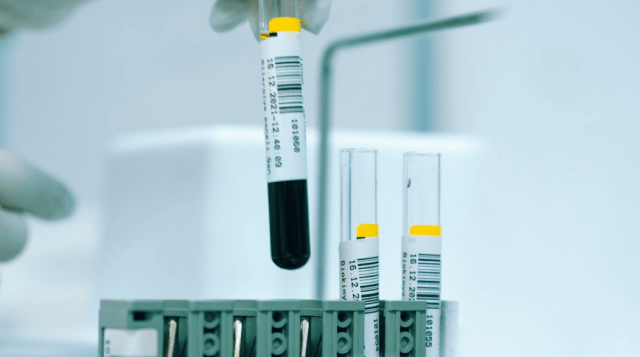 A Scandal That Could and Should Have Been Avoided