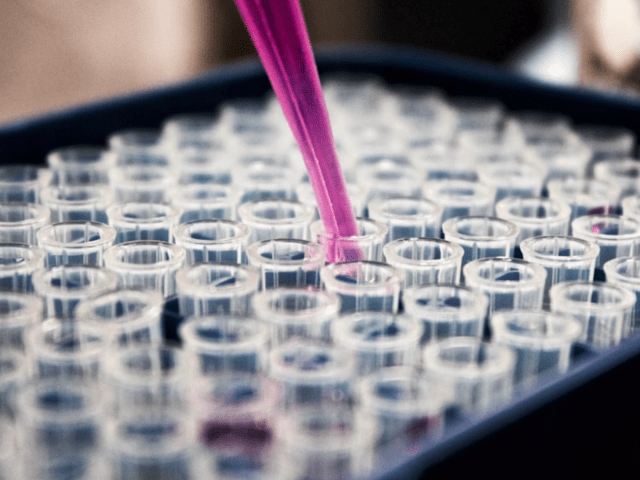 Yorkshire Woman Undergoes HIV Test After GP Uses Contaminated Swab