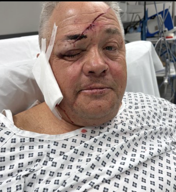 Brave Newcastle Fan Hospitalised After Tackling Knife-Wielding Intruder on Eve of Wembley Trip