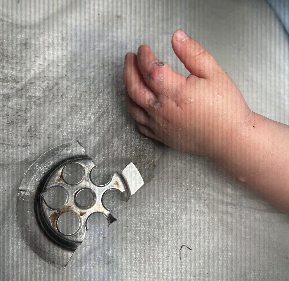 Firefighters Free Toddler After Fingers Get Stuck in Plughole