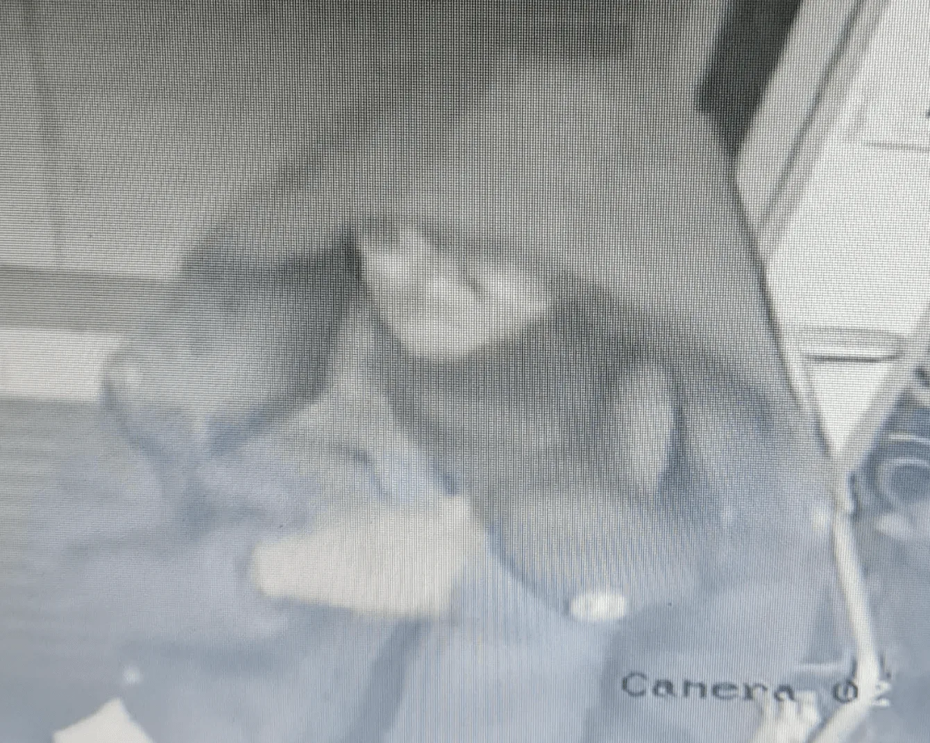 CCTV images released after teenager stabbed in South London â€“ (ID 558020)