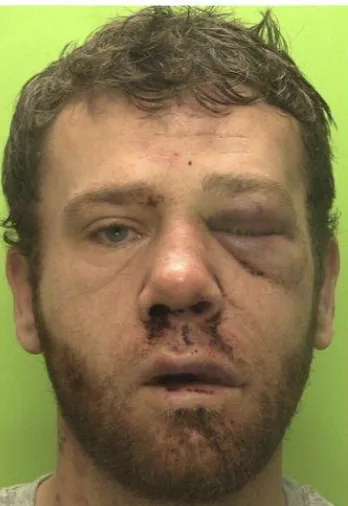Scissor Stabber Locked Up for Ten Years After Rampage in Nottingham