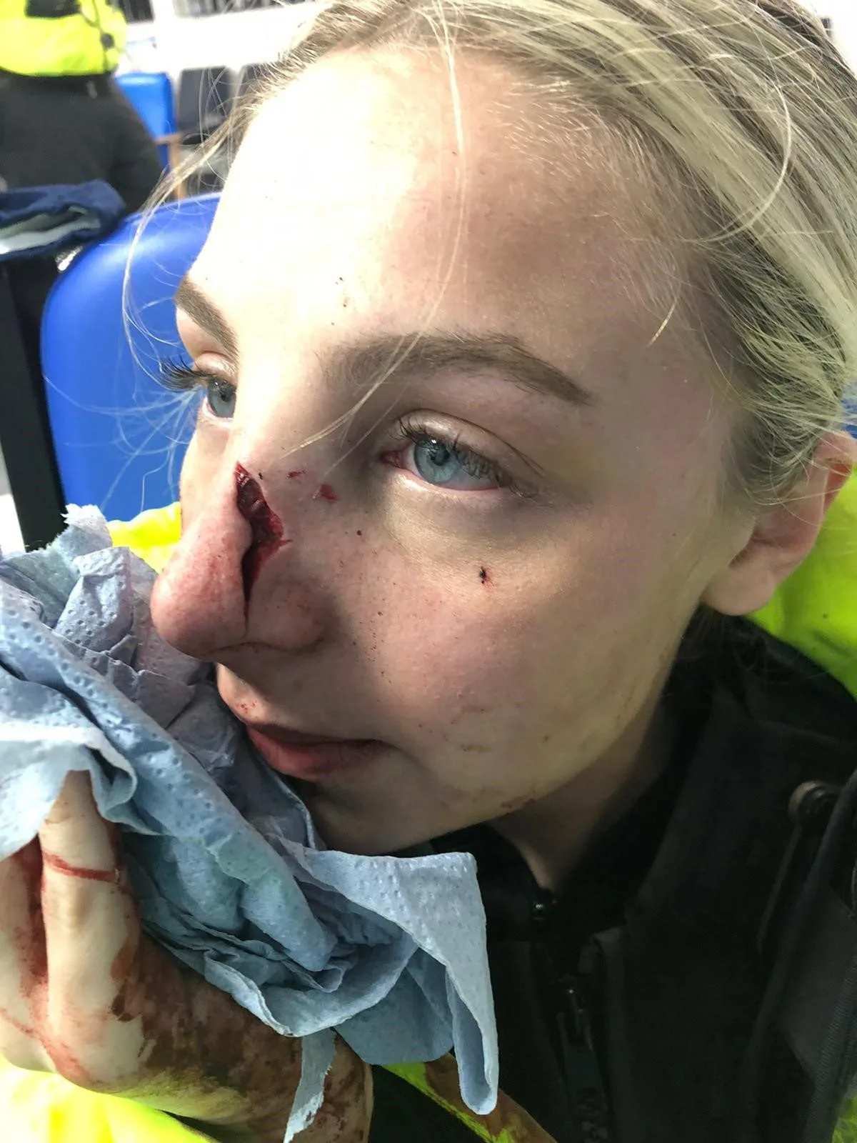 Teenager Slapped with Community Order After Savage Attack Leaves Policewoman Fighting for Breath