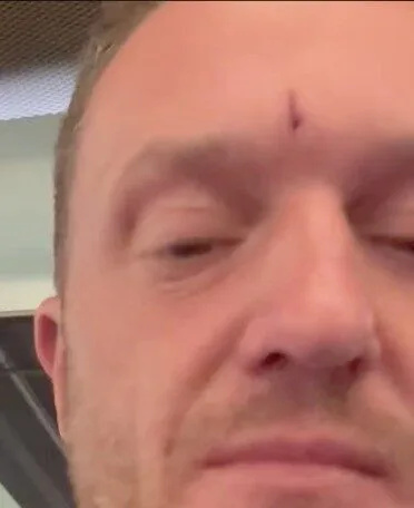 Police Probe Launched After Man Knocked Unconscious at St Pancras Station Amid Tommy Robinson Appearance