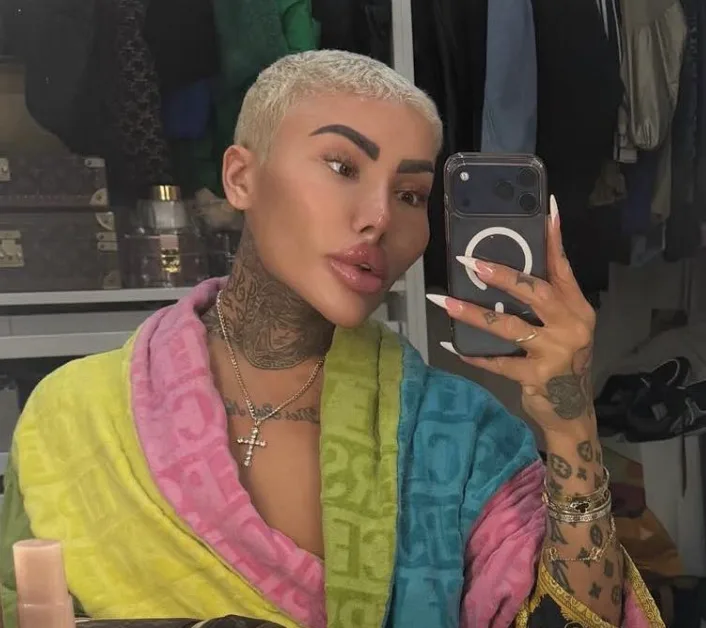 Two Bailed After Arrest Over â€˜Lip Kingâ€™ Jordan James Parkeâ€™s Death in Canary Wharf Cosmetic Procedure