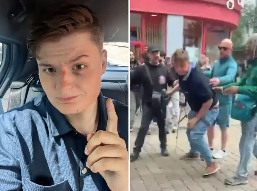Young Bob Describes Assault as ‘Most High-Profile Case’ Says Police