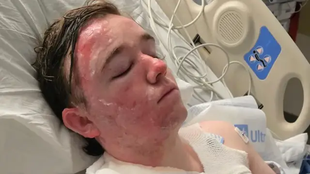 McDonald’s Worker in ICU Following Assault with Hot Oil by Co-Worker