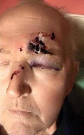 Man Knocked To The Floor And Injured By Mastiff Type Dog In Portsmouth